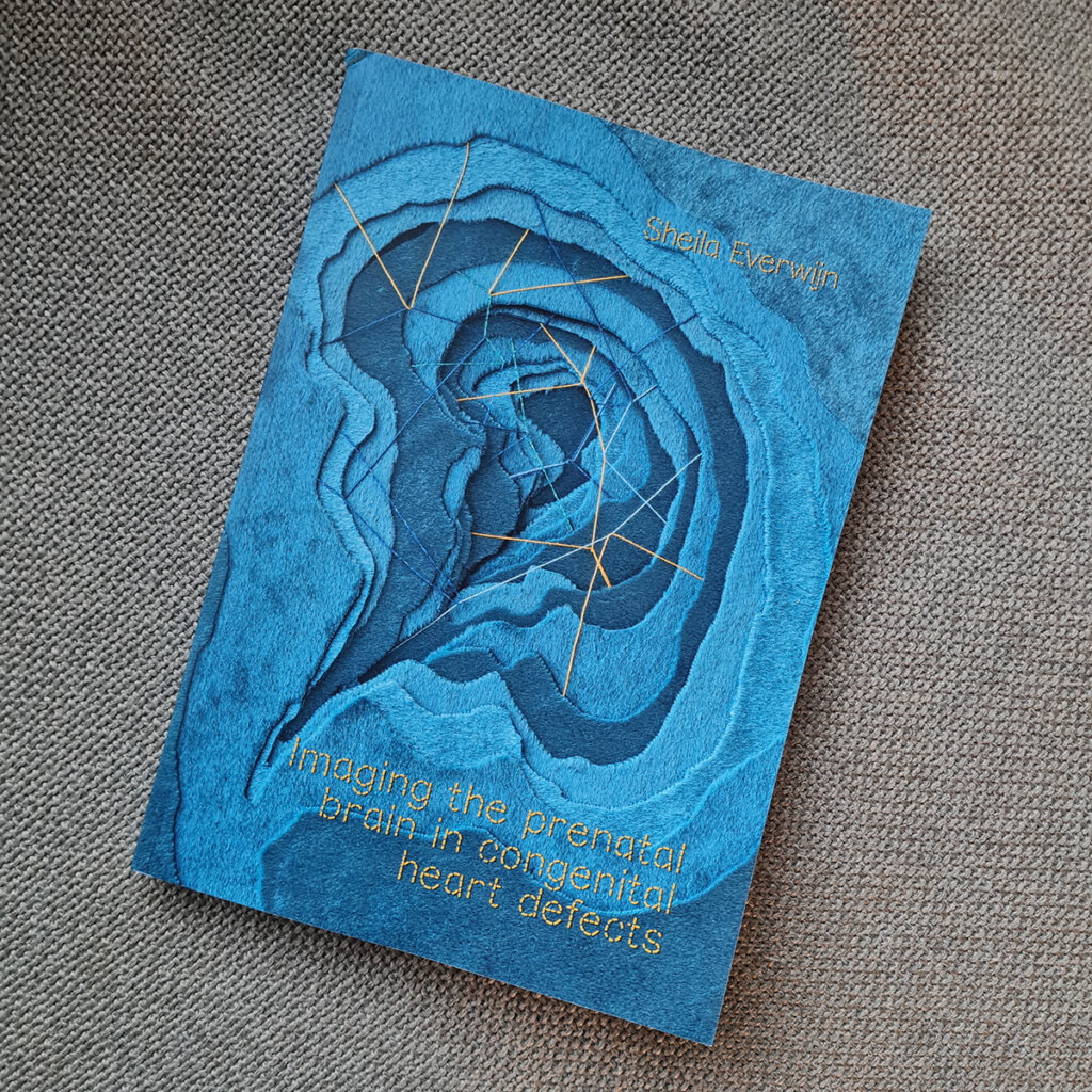 Book cover: Imaging the prenatal brain in congenital heart defects, Sheila Everwijn